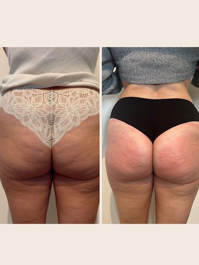 S.bodylift- Drainage Lymphatique -Lipocavitation - Madérotherapie- Lifting Colombien-Radiofréquence-Kobido- Institut De Beauté à Castres